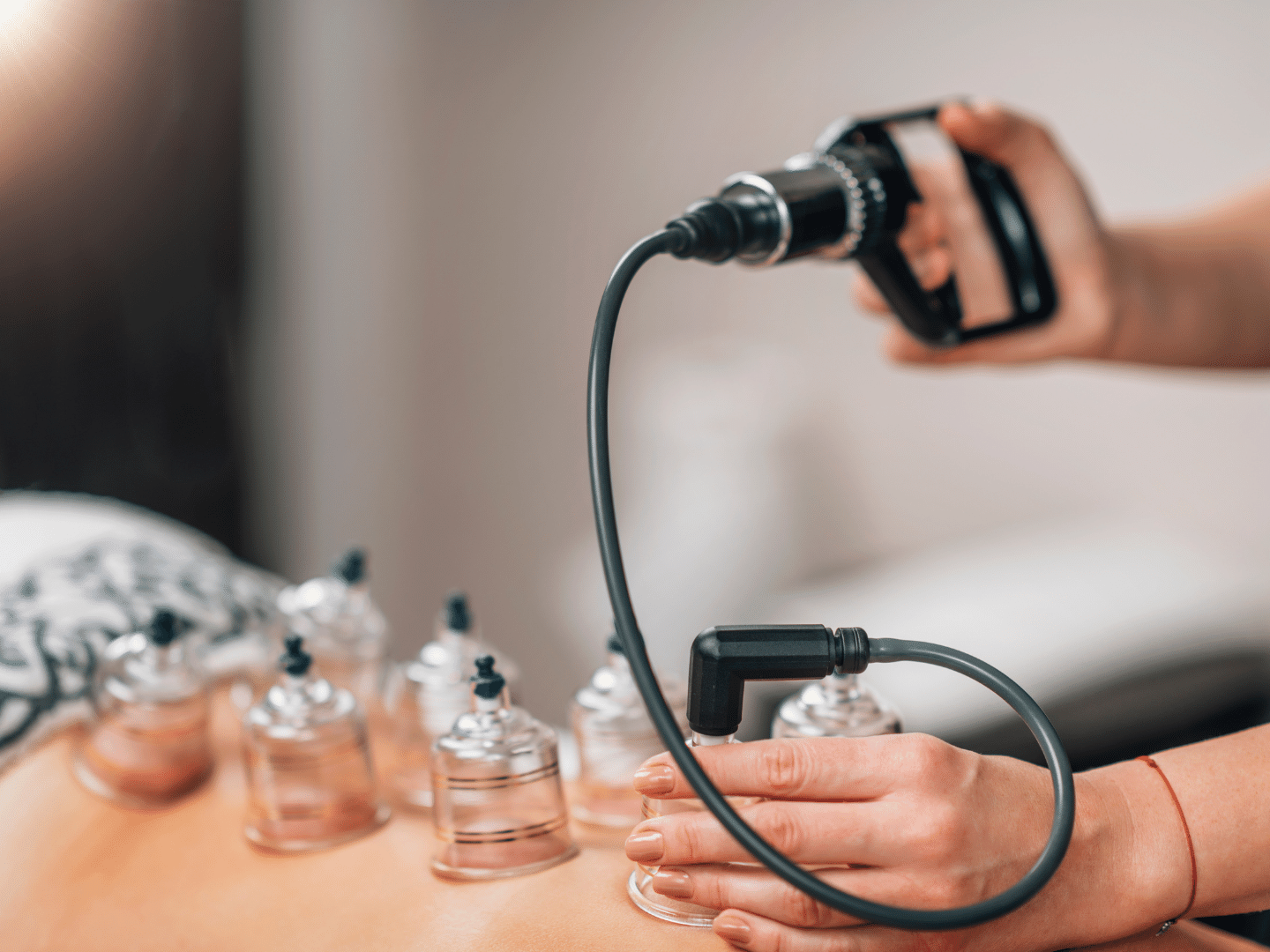 Reveal Whether Cupping Therapy is the Right Choice for You